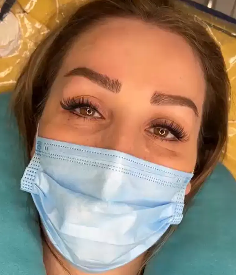 کاشت و اکستنشن مژه
