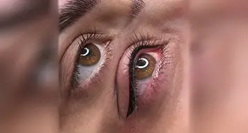 آرایش دائم چشم و ابرو